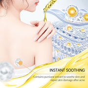 cerave blemish control cleanser