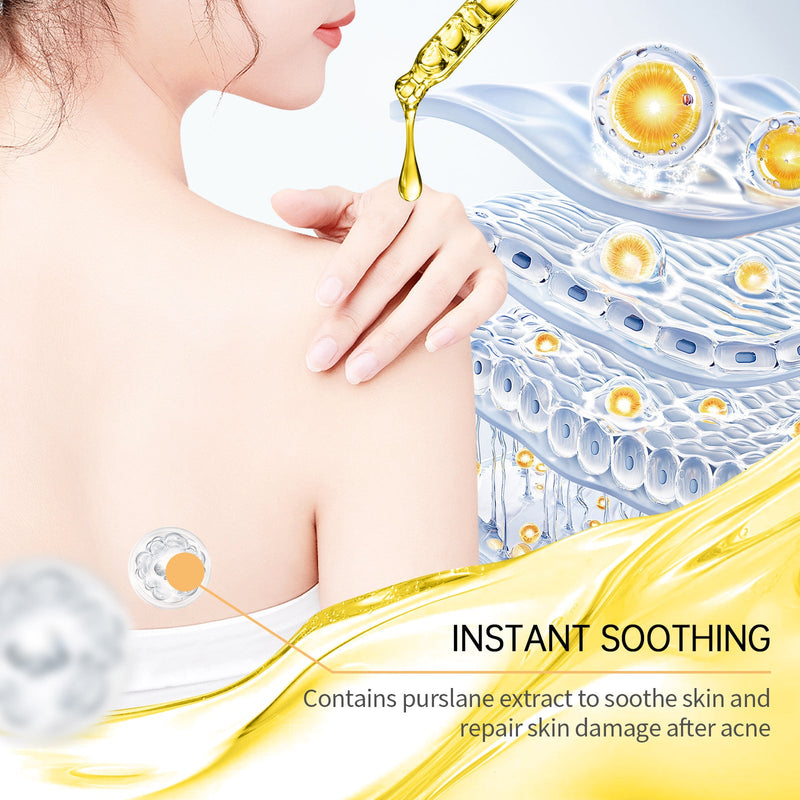 cerave blemish control cleanser