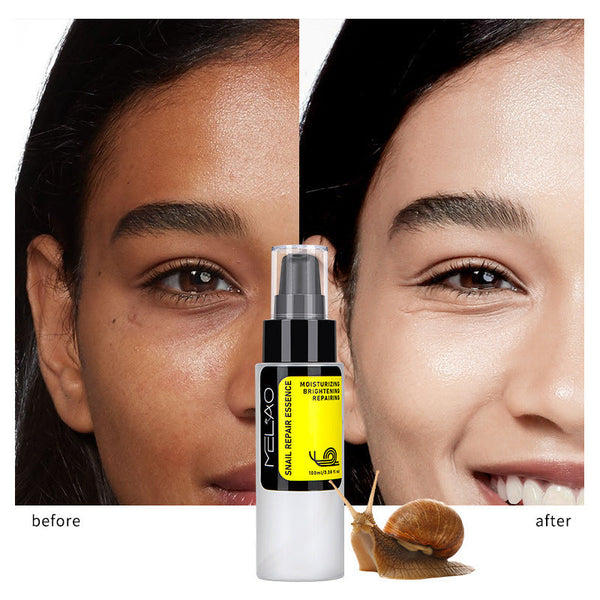 snail cream