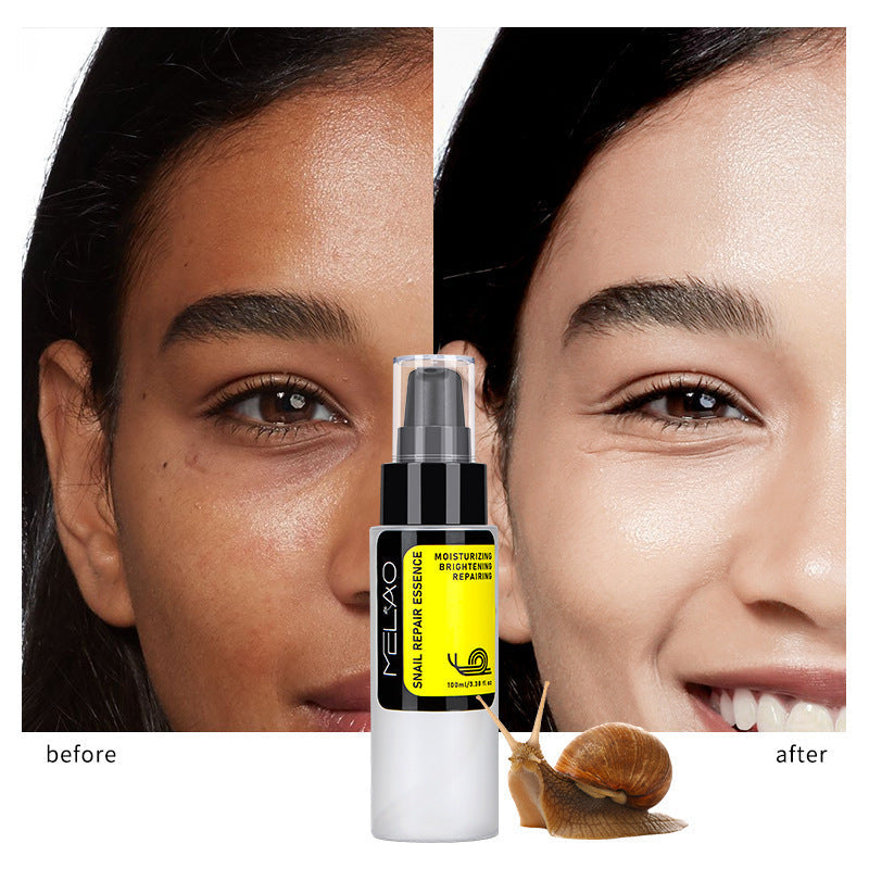 snail cream