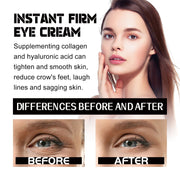 EELHOE Eye Firming Cream - Reduce Fine Lines & Wrinkles, Boost Firmness, Hydrate & Revitalize Delicate Skin